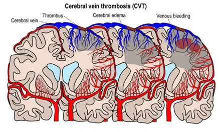 Picture10 - drsavyasachijain.com Picture10