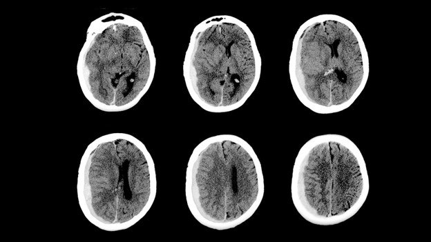 Picture12 - drsavyasachijain.com Picture12