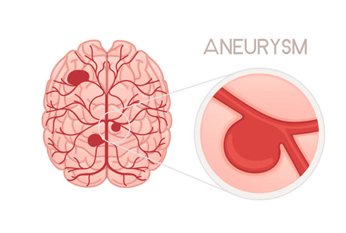 Picture5 - drsavyasachijain.com Picture5