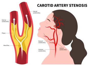 Picture8 - drsavyasachijain.com Picture8