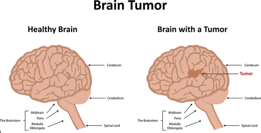 Picture9 - drsavyasachijain.com Picture9